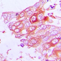 MUC13 Rabbit Polyclonal Antibody