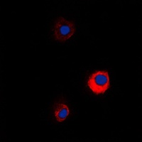 MUC13 Rabbit Polyclonal Antibody
