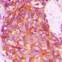 GPR159 Rabbit Polyclonal Antibody