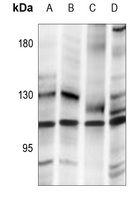 SENP7 Rabbit Polyclonal Antibody