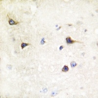 SENP7 Rabbit Polyclonal Antibody