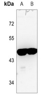 ARRDC3 Rabbit Polyclonal Antibody