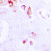 ARRDC3 Rabbit Polyclonal Antibody