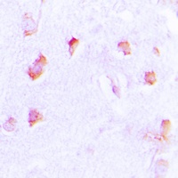 Collagen 20 alpha 1 Rabbit Polyclonal Antibody