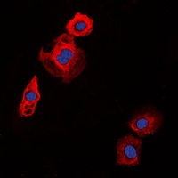 Collagen 20 alpha 1 Rabbit Polyclonal Antibody