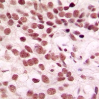 CTDSP1 Rabbit Polyclonal Antibody