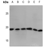 MYL7 Rabbit Polyclonal Antibody