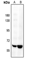 SENP2 Rabbit Polyclonal Antibody