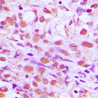 SENP2 Rabbit Polyclonal Antibody
