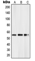 PKNOX2 Rabbit Polyclonal Antibody