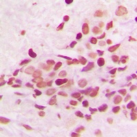 PKNOX2 Rabbit Polyclonal Antibody