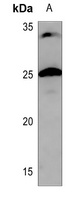 CHP2 Rabbit Polyclonal Antibody