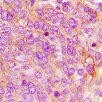MDA5 Rabbit Polyclonal Antibody
