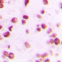 Artemis (Phospho-S516) Rabbit Polyclonal Antibody