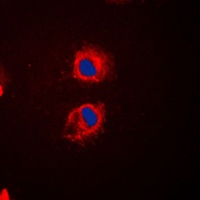EPS8L2 Rabbit Polyclonal Antibody