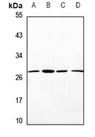 OTUB2 Rabbit Polyclonal Antibody