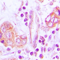 OTUB2 Rabbit Polyclonal Antibody