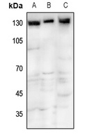 TRPM8 Rabbit Polyclonal Antibody