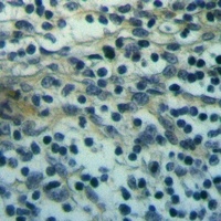 TRPM8 Rabbit Polyclonal Antibody