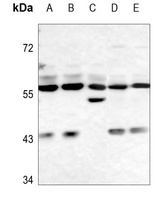 FTO Rabbit Polyclonal Antibody