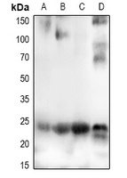 CHAC1 Rabbit Polyclonal Antibody