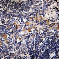Microcephalin Rabbit Polyclonal Antibody
