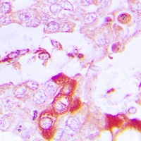 TRAF3IP3 Rabbit Polyclonal Antibody