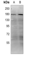 Collagen 18 alpha 1 Rabbit Polyclonal Antibody