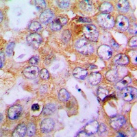 Collagen 18 alpha 1 Rabbit Polyclonal Antibody