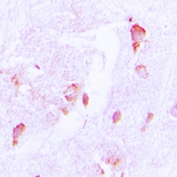 CSRNP2 Rabbit Polyclonal Antibody