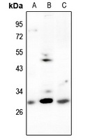 CDCA3 Rabbit Polyclonal Antibody