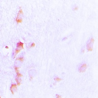 CDCA3 Rabbit Polyclonal Antibody