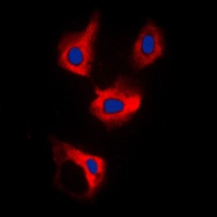 CDCA3 Rabbit Polyclonal Antibody