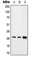 CIP29 Rabbit Polyclonal Antibody