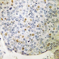 CIP29 Rabbit Polyclonal Antibody