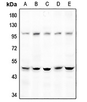 DGAT2 Rabbit Polyclonal Antibody