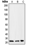 RAB2B Rabbit Polyclonal Antibody