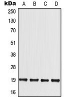 MED30 Rabbit Polyclonal Antibody