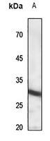 IL-22RA2 Rabbit Polyclonal Antibody