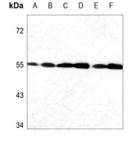 Caspase 12 Rabbit Polyclonal Antibody