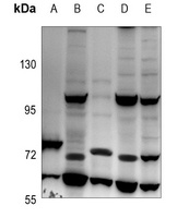 IL-31RA Rabbit Polyclonal Antibody