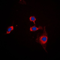 CD172a Rabbit Polyclonal Antibody