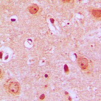 PTGR2 Rabbit Polyclonal Antibody