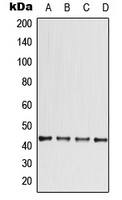 CCBE1 Rabbit Polyclonal Antibody