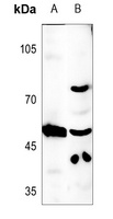 CLEC14A Rabbit Polyclonal Antibody