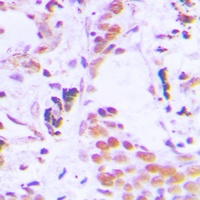 TCEB3C Rabbit Polyclonal Antibody