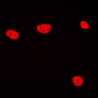 TCEB3C Rabbit Polyclonal Antibody