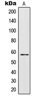 IL-28RA Rabbit Polyclonal Antibody