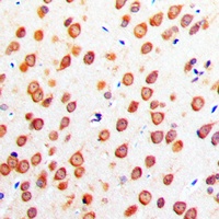 CADM4 Rabbit Polyclonal Antibody