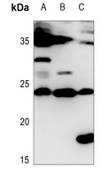 IL-28A Rabbit Polyclonal Antibody